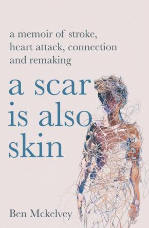 A Scar is Also Skin